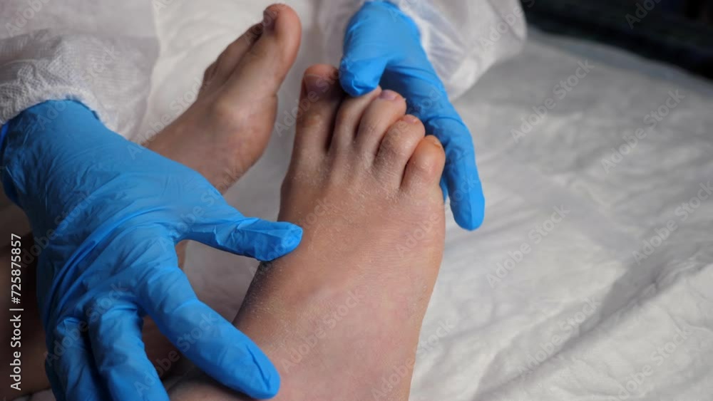 Vidéo Stock Treatment of dermatitis at home. Family doctor