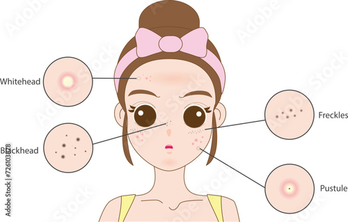 Troubled woman and set of most common female facial skin problems needs to care about: acne ,Freckle and dull skin.
