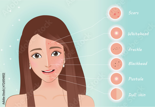 Troubled woman and set of most common female facial skin problems needs to care about: acne ,Freckle and dull skin.