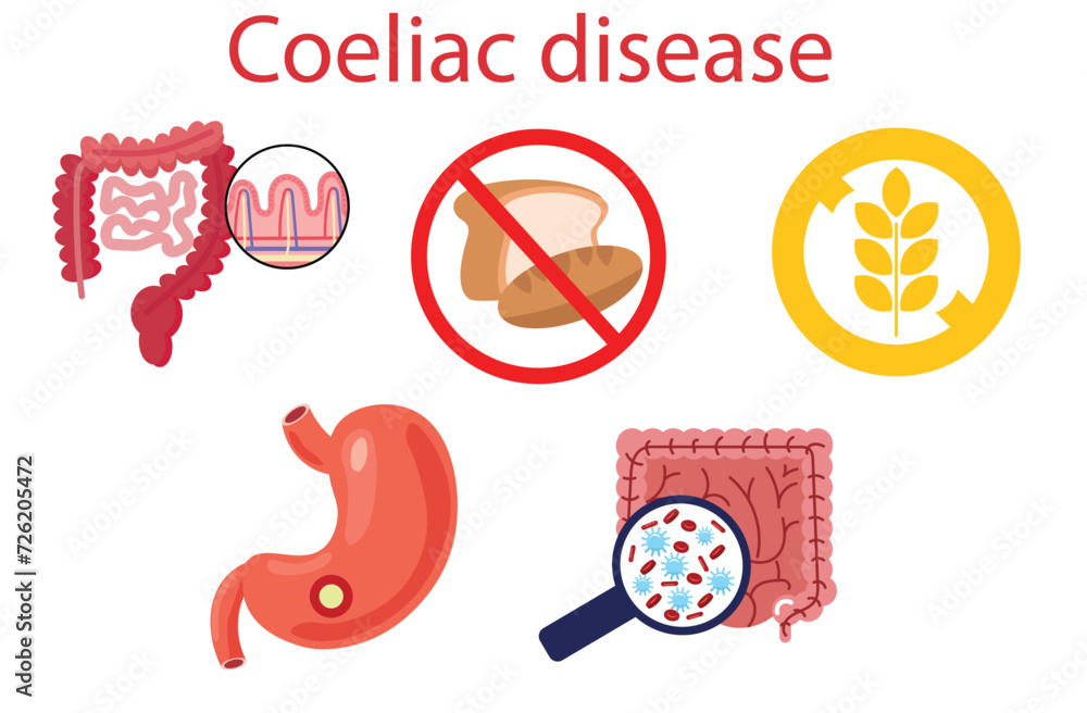 coeliac disease,Coeliac disease or celiac disease (gluten-sensitive ...