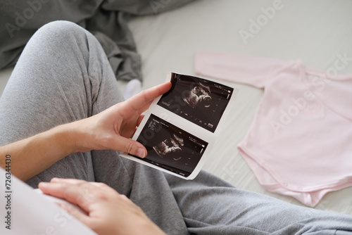 A young pregnant woman gently holds an ultrasound picture of her baby in her hands while sitting on the bed in the bedroom. Maternity concept.