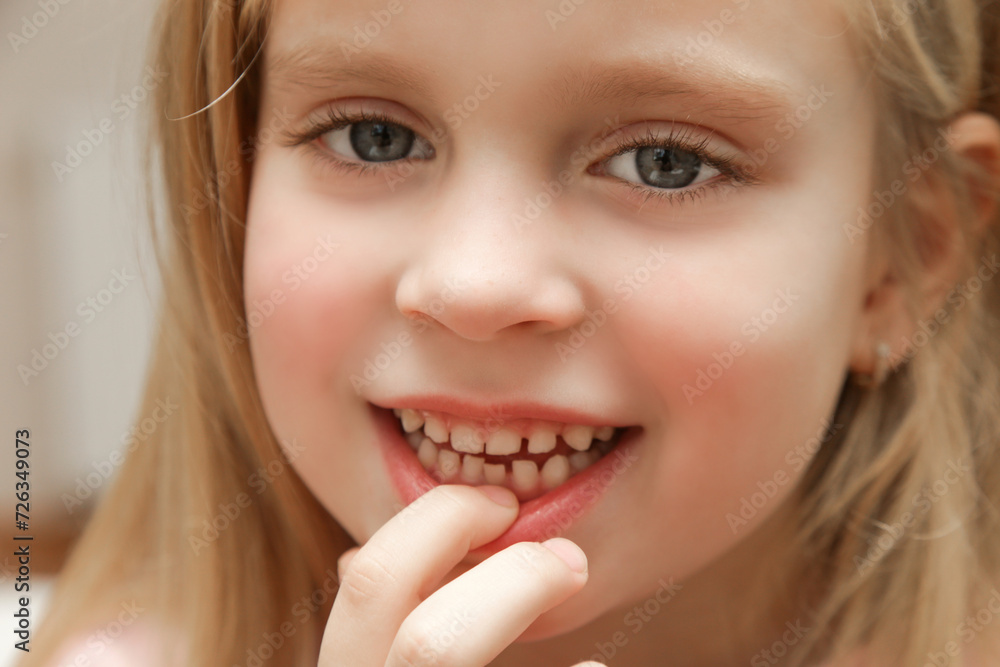 Cute preschool girl showing a loose primary (baby) tooth Cute preschool girl showing a loose primary (baby) tooth