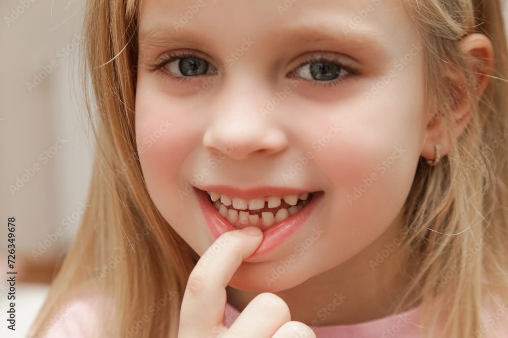 Cute preschool girl showing a loose primary (baby) tooth Cute preschool girl showing a loose primary (baby) tooth