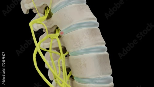 A herniated disc protrusion enlarges compressing a nerve root and causing pain. 3D animation isolated on a black background
