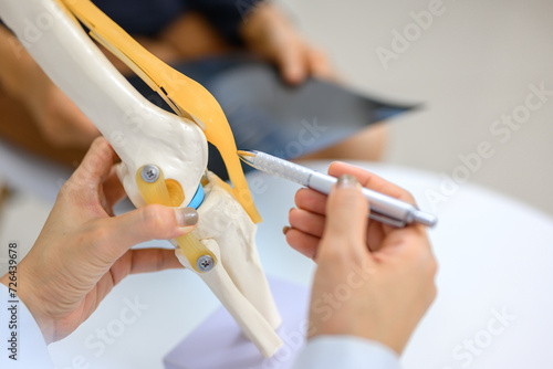 Bilde på lerret An orthopedic surgeon demonstrates a knee bone model and explains the treatment of cruciate ligament injury using this model