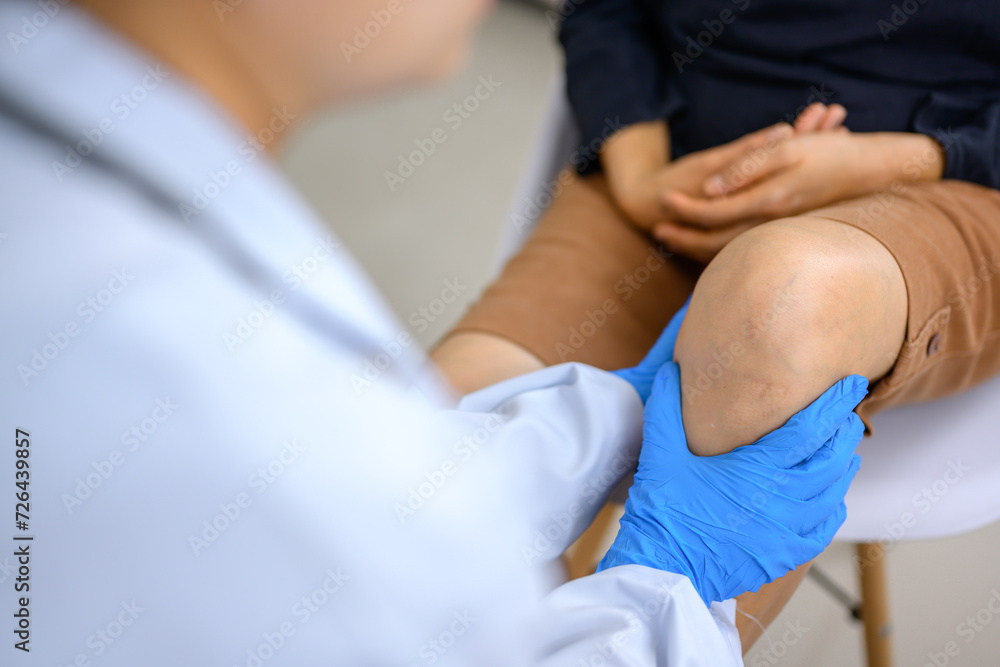 Obraz premium A doctor is examining the knee of a woman who has a knee injury. Foot treatment with an orthopedic surgeon will treat pain caused by running or exercising incorrectly