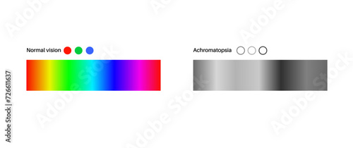 Achromatopsia vision deficiency