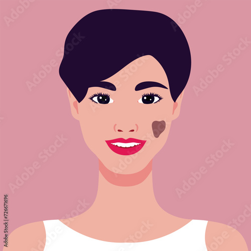 Beautiful smiling young woman with a birthmark on her face. Rare appearance. Portrait or an avatar. Vector illustration