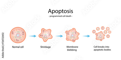 Apoptosis. Programmed cell death. Aging process in cells. Stages of apoptosis, normal cell, shrinkage, membrane blebbing, cell breaks into apoptotic bodies and phagocytosis. vector illustration.