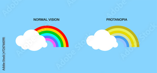 Protanopia and normal vision
