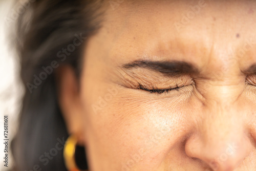 Close-Up of a Woman's Face Expressing Discomfort