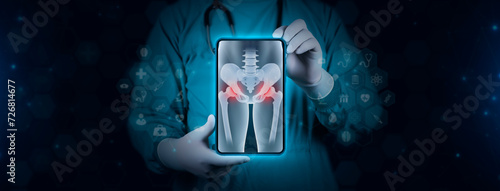 The doctor holds a tablet and examines a pelvic x-ray in digital format. Pain in the cartilage joints, femoral head. Pelvis, degenerative hip disease. Arthritis and osteoarthritis photo
