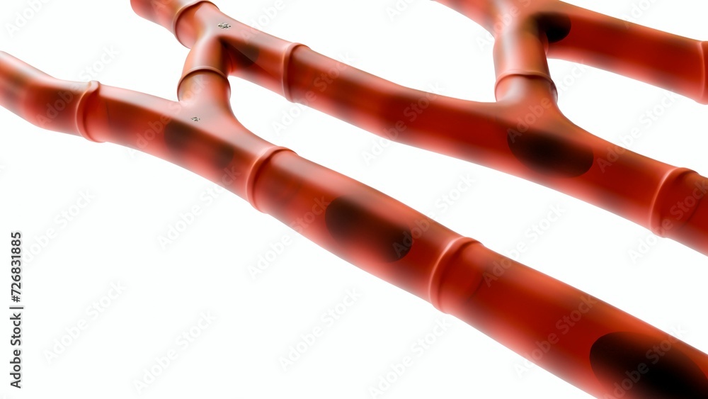type of muscle tissue in heart