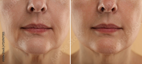 Aging skin changes. Woman showing face before and after rejuvenation, closeup. Collage comparing skin condition photo
