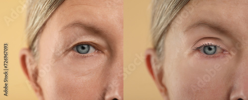 Aging skin changes. Woman showing face before and after rejuvenation, closeup. Collage comparing skin condition