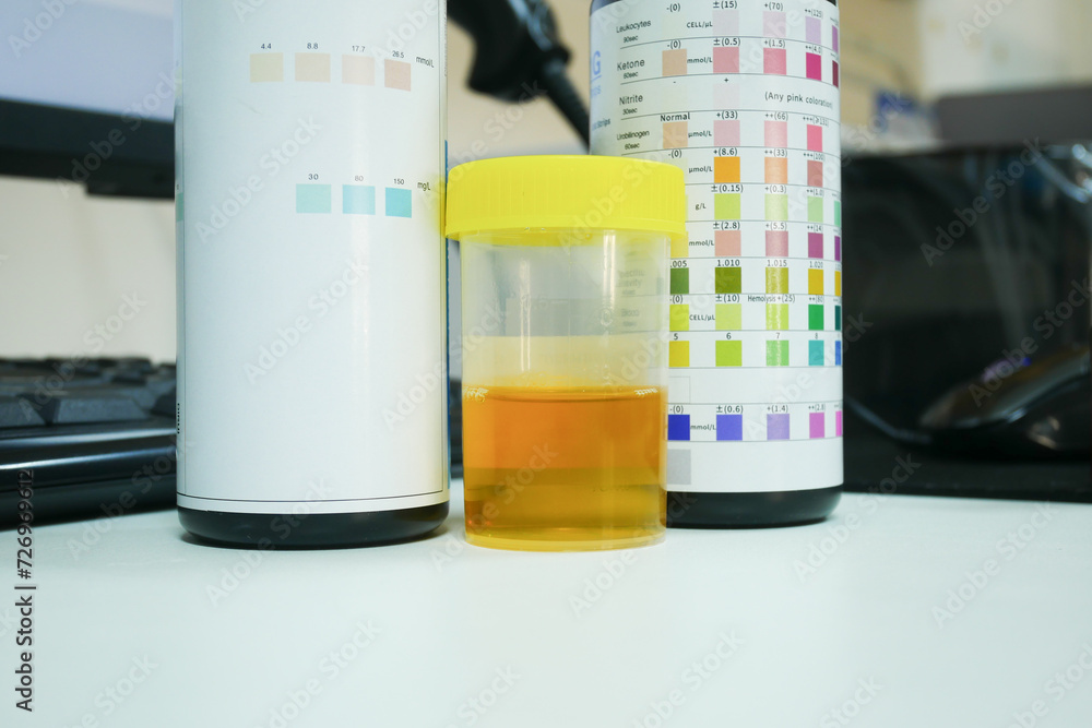 Urine analysis in laboratory.