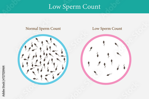 normal and low sperm count illustration. eps 10
