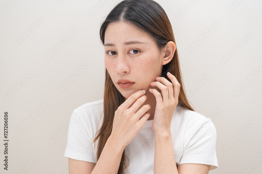 Dermatology, expression face worry, stressed asian young woman hand touching face at dark spot of melasma, freckle from pigment melanin, allergy sun. Beauty care, skin problem treatment, acne skincare Dermatology, expression face worry, stressed asian young woman hand touching face at dark spot of melasma, freckle from pigment melanin, allergy sun. Beauty care, skin problem treatment, acne skincare