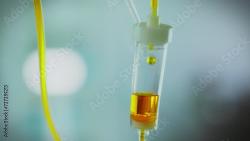 IV drip in action. Conducts drip treatment. The bright liquid medicine drips slowly while keeping the level in the expansion capsule. Supported by modern technology, iv drip drop falls