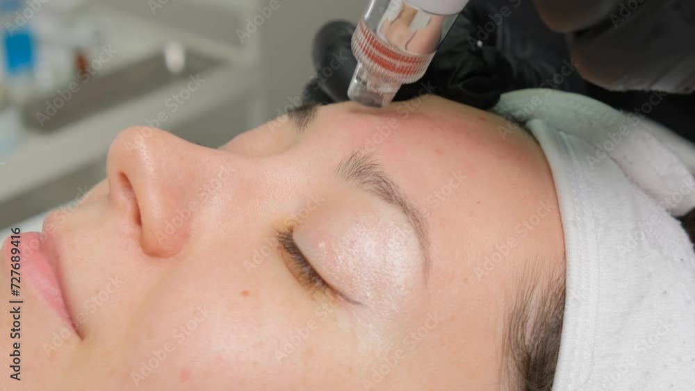 A close-up cosmetologist manipulates a hydropeeling machine to clean and rejuvenate a patient's skin in a modern clinic. A close-up cosmetologist manipulates a hydropeeling machine to clean and rejuvenate a patient's skin in a modern clinic.