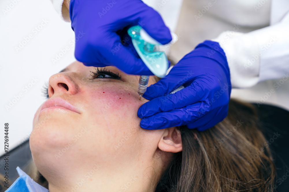 Aesthetician administers a precise hyaluronic acid injection into a patient's chin, focusing on cosmetic enhancement and care. Aesthetician administers a precise hyaluronic acid injection into a patient's chin, focusing on cosmetic enhancement and care.