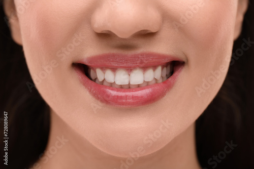 Woman with clean teeth smiling, closeup view
