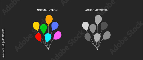 Achromatopsia vision deficiency