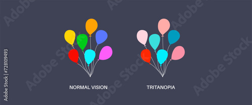 Tritanopia and tritanomaly