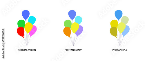 Protanomaly and protanopia