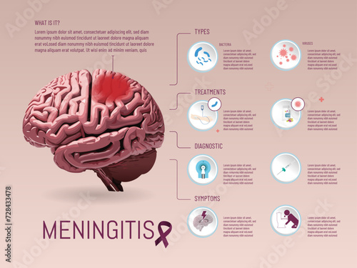 Infographics about Meninguitis, symptoms, treatments, types, brain image created with AI, on a solid color background, and icons added with illustrator.

