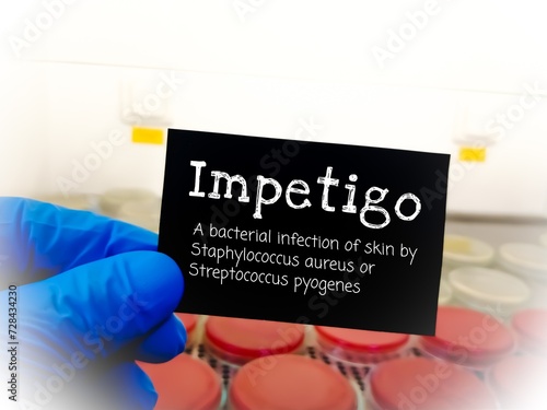 Impetigo term. Medical conceptual image. photo