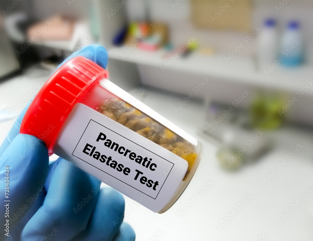 Pancreatic elastase test is used check for exocrine pancreatic insufficiency (EPI)