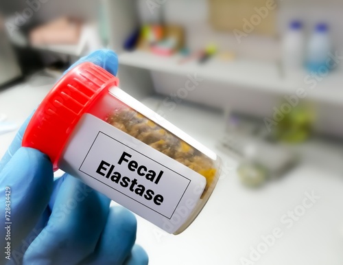 A Fecal elastase test is used check for exocrine pancreatic insufficiency (EPI) photo