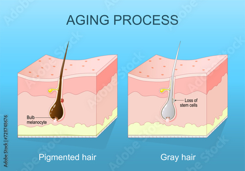 aging process. Graying hair.