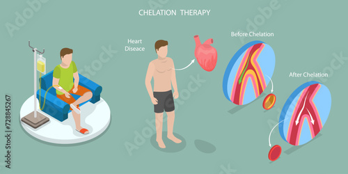 3D Isometric Flat Vector Illustration of Chelation Therapy, Toxic Heavy Metal Medical Treatment