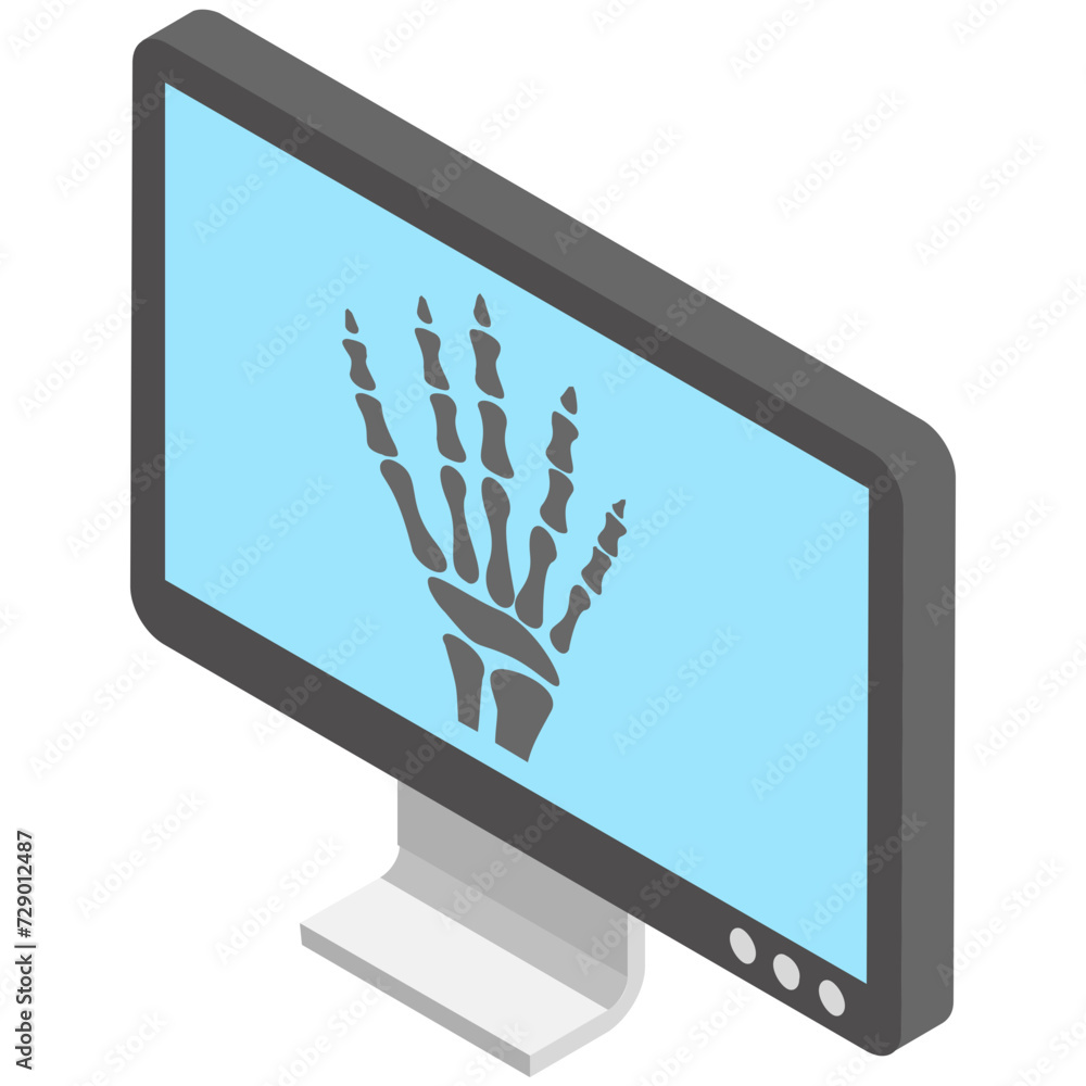 Xray Radiography, Radiology, Xray Imaging, Xray Machine, Xray Scan