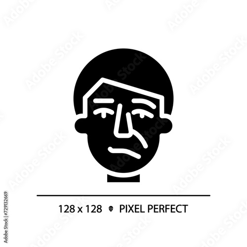 Facial nerve paralysis black glyph icon. Bells palsy. Neurological medical condition. Physiotherapy injury recovery. Silhouette symbol on white space. Solid pictogram. Vector isolated illustration