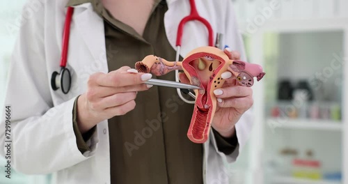 Doctor gynecologist demonstrates model of female reproductive system photo