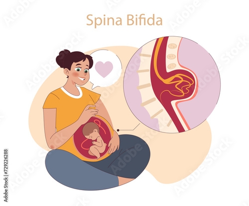 Spina Bifida concept. Expectant mother visualizes her baby's condition with love and hope. Prenatal care and birth defects.