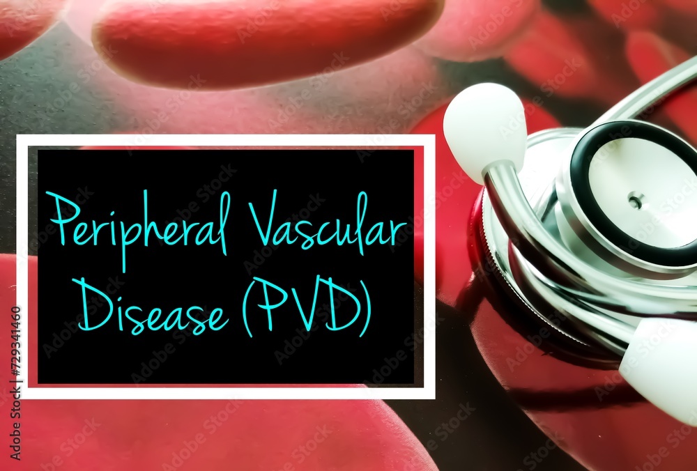 Peripheral vascular disease (PVD) medical term, PVD is a systemic ...