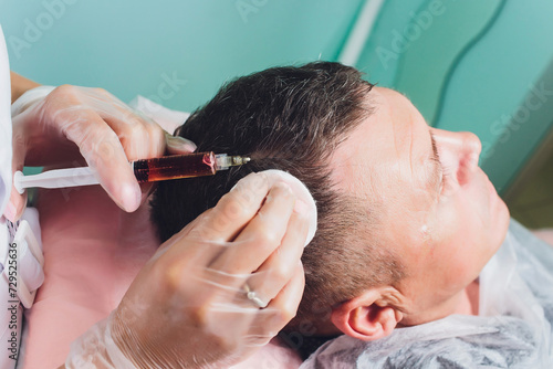 Treatment of baldness with beauty injections. Cosmetologist hands in gloves make a subcutaneous injection. Plasmalifting male patient. photo