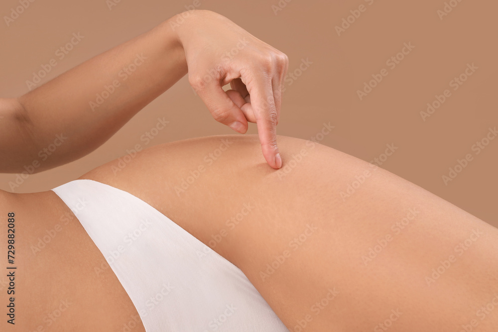 Fototapeta premium Beautiful young African-American woman with stretch marks on her body against beige background, closeup