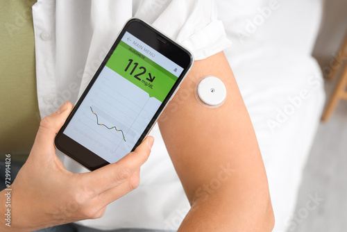 Diabetic woman with glucose sensor using mobile phone for measuring blood sug...