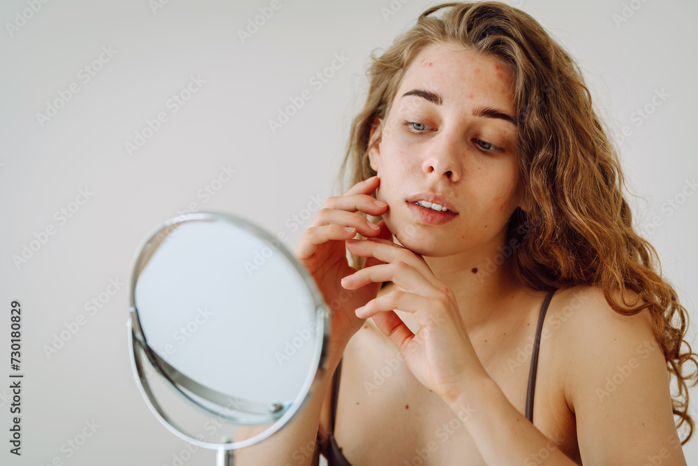 Portrait of a beautiful woman without makeup with imperfect skin. Acne skin. Natural beauty. Medical care and treatment concept. Portrait of a beautiful woman without makeup with imperfect skin. Acne skin. Natural beauty. Medical care and treatment concept.