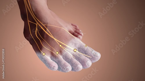 Tingling nerve injury in foot photo