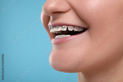 Happy woman with dental braces on light blue background, closeup. Space for text