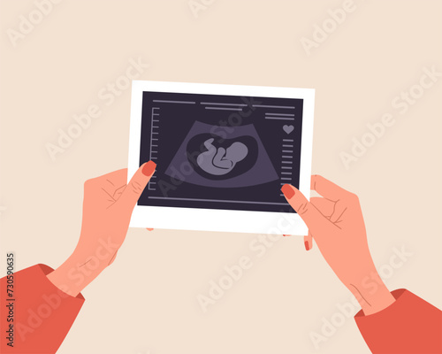 Ultrasound of baby. Female hands holding fetus silhouette photo. Embryo in womb. Pregnancy screening. Baby health diagnostic. Sonography or ultrasonography concept. Cartoon vector illustration.