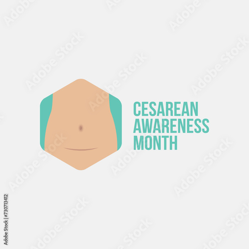Cesarean Awareness Month Vector Illustration. This yearly event raises awareness about caesarean sections (C-sections), highlighting their role in childbirth. flat style design
