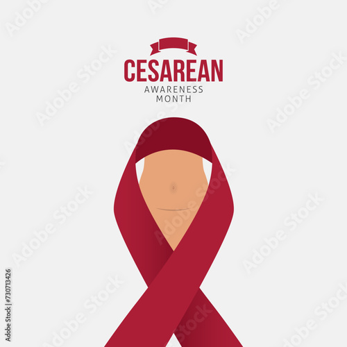Cesarean Awareness Month Vector Illustration. This yearly event raises awareness about caesarean sections (C-sections), highlighting their role in childbirth. flat style design