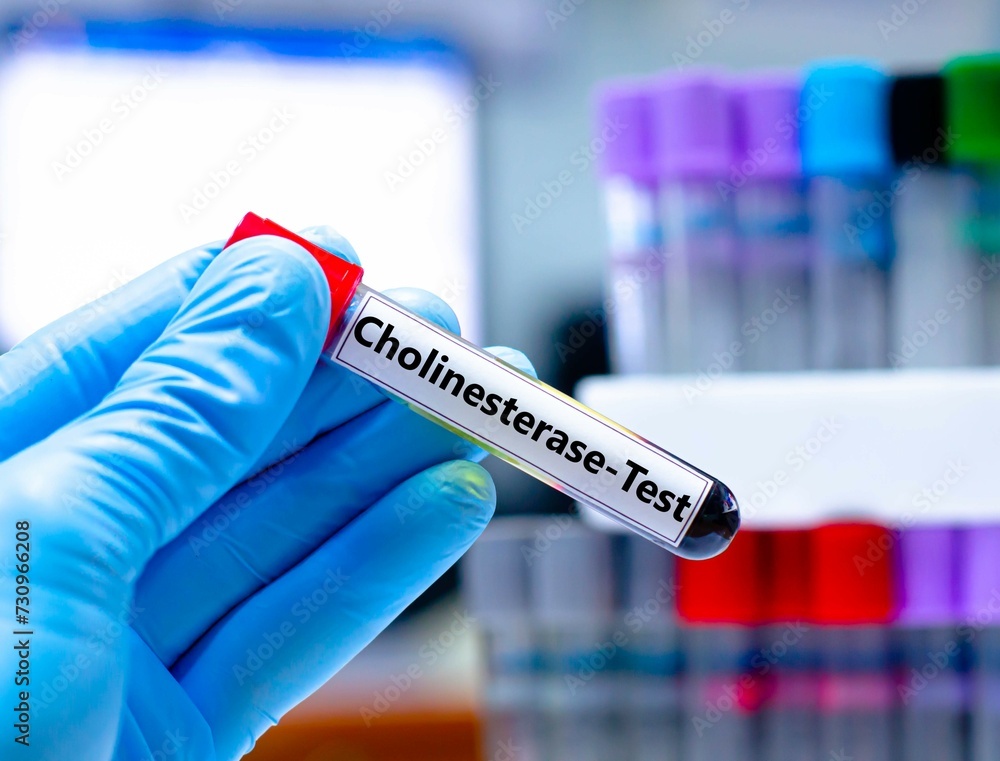 Blood sampling tube for cholinesterase test analysis. Blood sampling tube for cholinesterase test analysis.